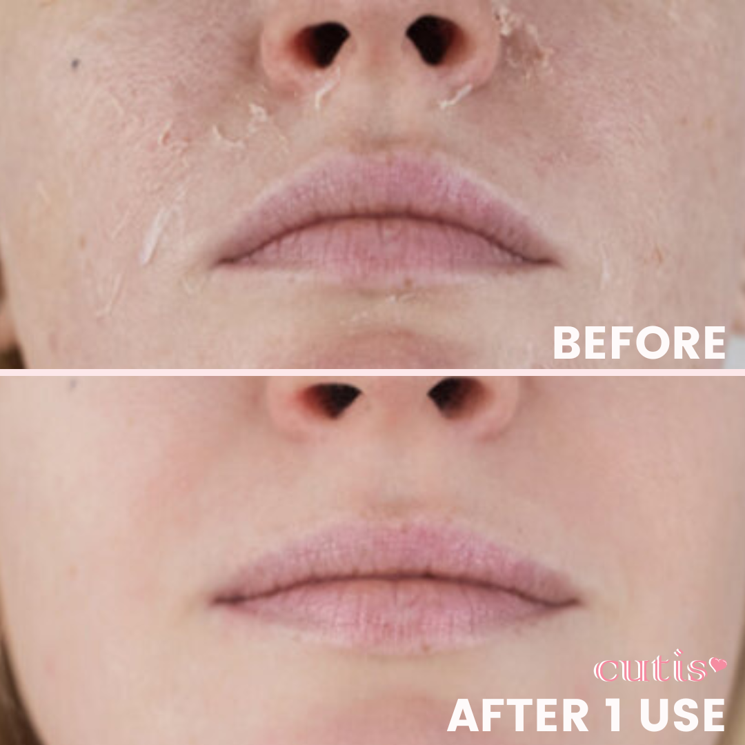 Cutis Luv Exfoliating Face Mitt